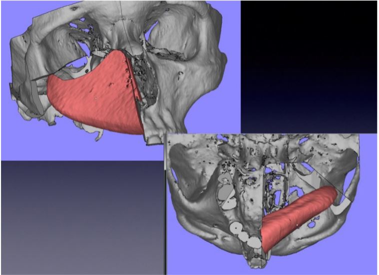 Figure 4.JPG